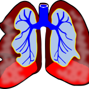 Medikamentöse Inhalation soll schwere Lungenentzündungen verhindern