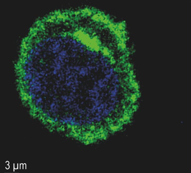 Hoffnung für Patientinnen und Patienten mit Multiplem Myelom