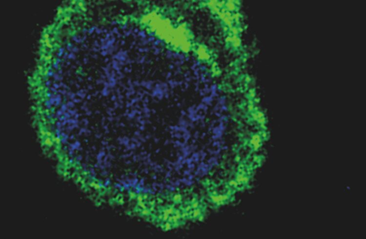 Hoffnung für Patientinnen und Patienten mit Multiplem Myelom